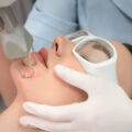 Beauty facial with laser treatment