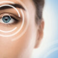 An image of a woman's blue eye with white circular graphics around the eye to represent the concept of eye surgery